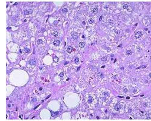 济南试管代怀群,少精，想做试管婴儿，请问青岛妇幼和济南省立比哪个好？_上