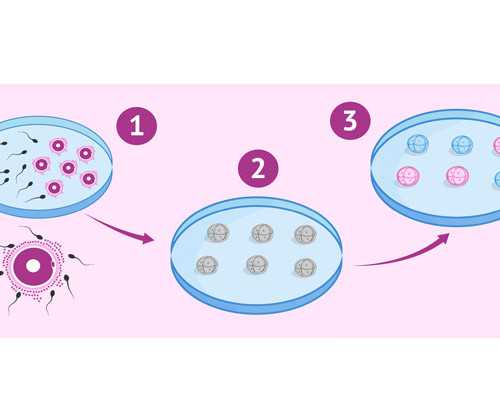 济南权威代孕医院排名,子宫小会影响试管婴儿吗？试管移植的步骤是什么？-济