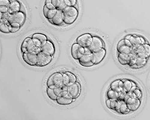 济南全包代怀套餐,北京哪家试管婴儿医院好 胚胎移植后保胎注意事项_济南铁路