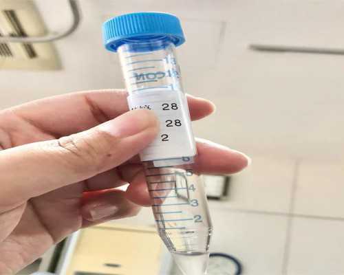 为什么没有来月经却有褐色血？