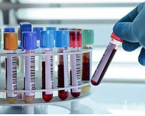 济南找的好代孕公司,济南精子库报销路费，济南地下精子库