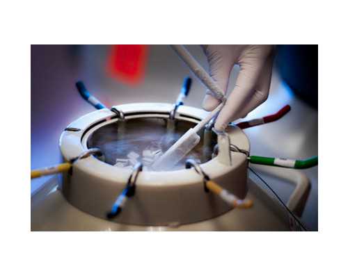 济南好的供卵机构,试管婴儿移植后肚子胀什么原因？-试管促排期间可以喝红糖