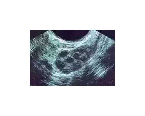 济南一周疫情数据动态流动趋势图