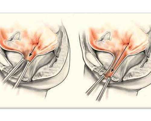 外地人在济南上私立幼儿园需要本地户口吗？,济南三代试管20万包成功包男孩的